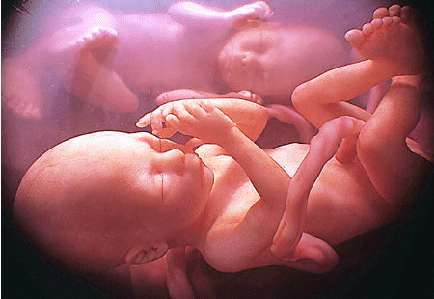late-term-double-image-fetus